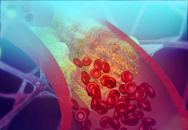 high blood pressure in blood vessel